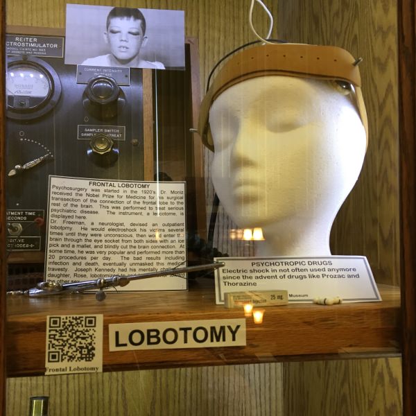 Lobotomy