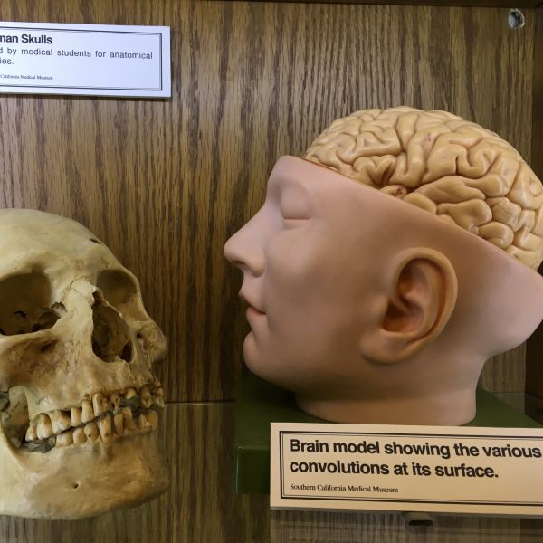 Skull and Brain